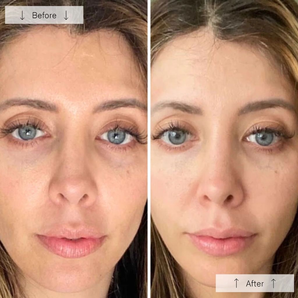 Contour Face - Image 9